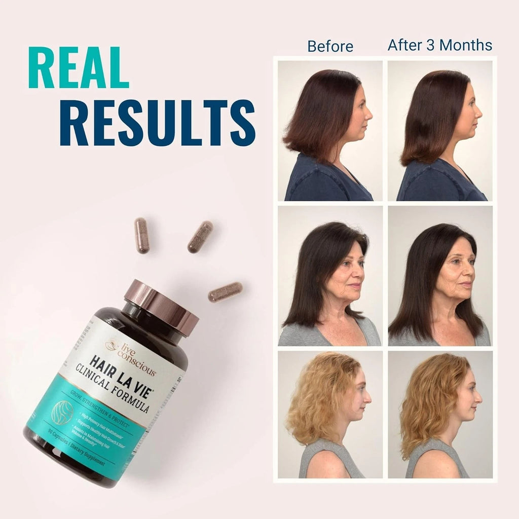 Hair La Vie Clinical Formula Hair Vitamins for Hair Regrowth, 90 Caps Pack of 2